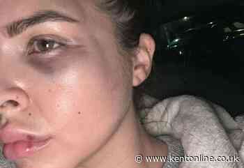 Mum left with broken cheekbone after nightclub attack