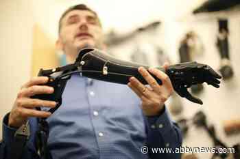 B.C. group lends a helping hand to Ukraine, setting up prosthetic clinics