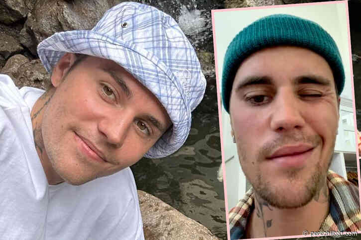 Justin Bieber Shares Update On Facial Paralysis Following Ramsay Hunt Syndrome Diagnosis