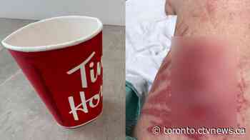 Woman suing Tim Hortons for $500K after hot tea spill left her 'disfigured'