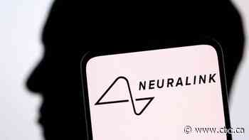 Neuralink, Elon Musk's brain implant company, says it's received FDA approval for human trials