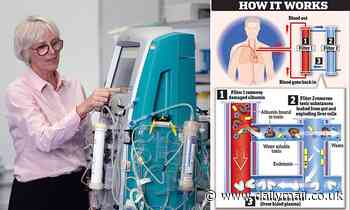 New British-designed dialysis machine that can reverse liver disease may be rolled out to NHS 