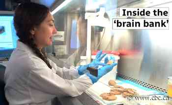 This Montreal lab houses thousands of brains