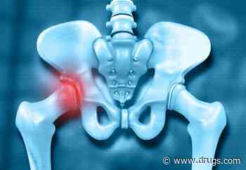 Sliding Hip Screws Feasible for Trochanteric Fractures