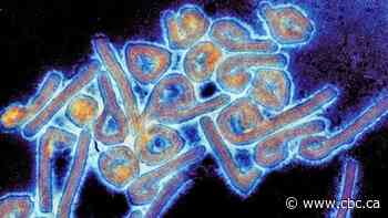 Outbreak of deadly Marburg virus ends in Equatorial Guinea: WHO
