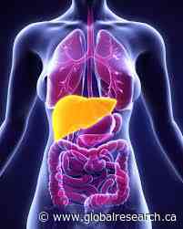 30% of Americans Have Fatty Liver Disease