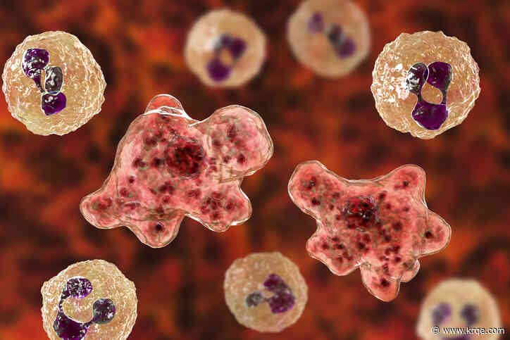 Deadly brain-eating amoeba: How concerned should you be this summer?
