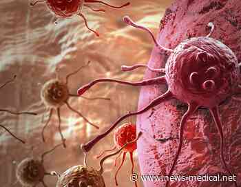 AI tool can quickly diagnose muscle wasting in head and neck cancer patients