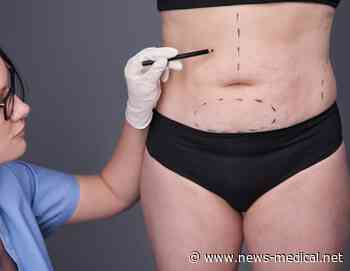 Bariatric surgery linked to lower cancer risk in women
