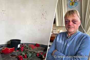 Jan (56) bont en blauw geslagen tijdens brutale overval bij hem thuis: “Hij herhaalde wel tien keer dat hij mij zou doden”