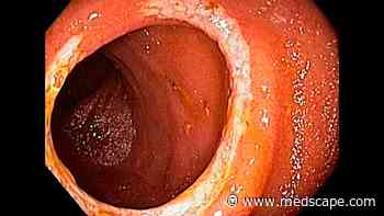 Capsule Endoscopy–Guided Treatment Reduces Flares in Crohn's