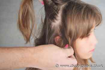 Head lice rules and whether you can send your children to school if they have nits
