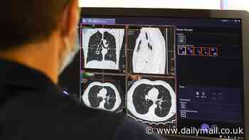 Scientists are making a 'groundbreaking' lung cancer vaccine that could prevent up to 90% of cases