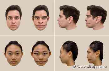 Rare Condition Makes Others' Faces Appear 'Demonic'