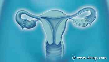 Uterine Artery Embolization Successfully Controls Postpartum Hemorrhage
