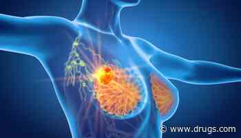 Cryoablation Effective in Breast Cancer Patients, Even With Large Tumors