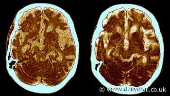 Scientists find human brain has grown by whopping 7% since 1930... but there are signs IQs have gone backwards in recent years