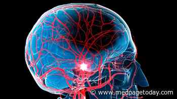 Most Post-Stroke Depression Strikes Within 5 Years