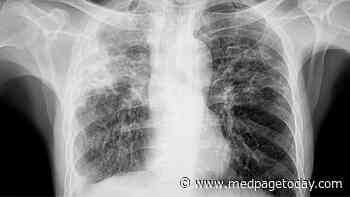 New Tuberculosis Framework May Improve Research, Clinical Care