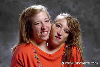 Conjoined twin Abby Hensel is now married