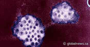 Norovirus cases spiking in U.S. What about Canada?