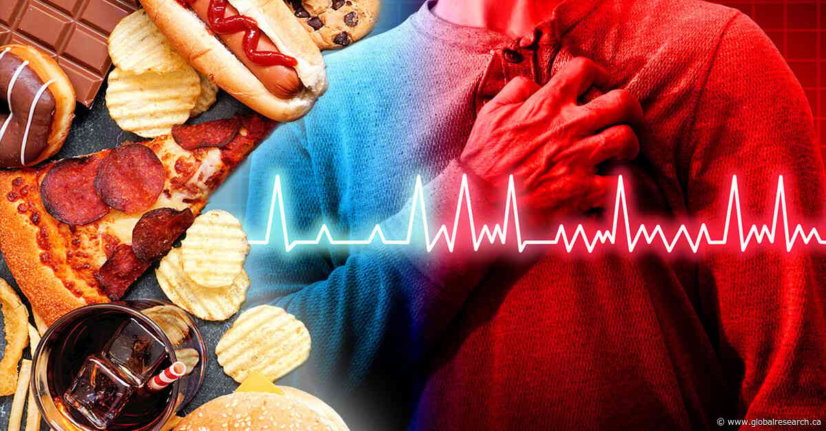 Comer alimentos ultraprocessados ​​pode aumentar o risco de ataque cardíaco e derrame em até 21%