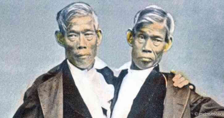The conjoined twins who had 21 children between them