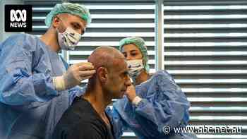 How Türkiye turned itself into the hair transplant capital of the world — and built a $3b industry