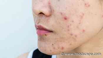 What's Behind Long-Term Antibiotic Prescribing for Acne?