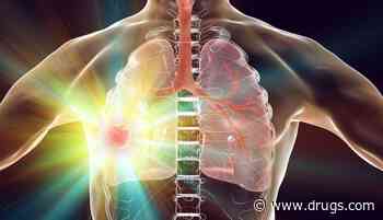 Adjuvant Alectinib Improves Disease-Free Survival in Lung Cancer