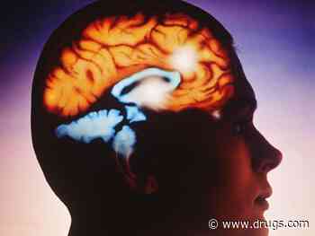 New Brain Target Key to Easing Tough-to-Treat Epilepsy