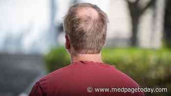 Oral and Topical Minoxidil Go Head-to-Head for Hair Loss in Men