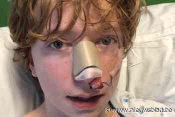 Yarne (16) houdt gebroken neus en kaakbeen, en hersenschudding over aan plotse aanval