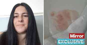 Mould, bed bugs and blood stains - Inside mum's Blackpool hotel from hell on nightmare getaway