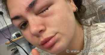 'Horrified' woman left blind in hospital after 'botched eyebrow tint'