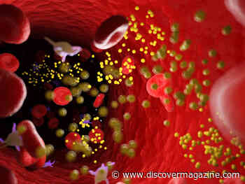 Everything to Know About Cholesterol