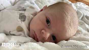 Cornish baby who lost eye to cancer faces new op