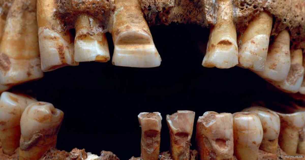 With no passports, Vikings filed grooves into their teeth for ID