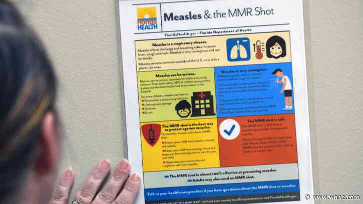 Health Department warns of possible measles exposure at the Children’s Museum of Indianapolis