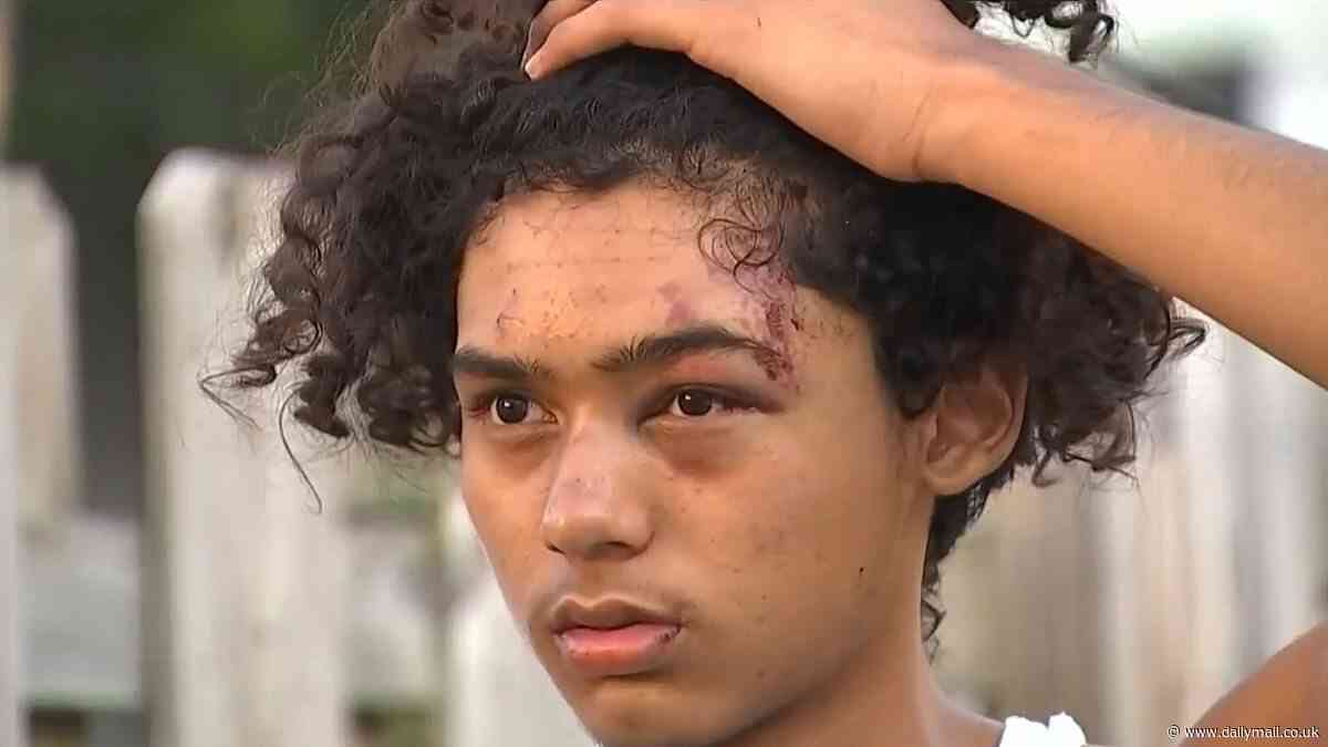 Horrifying moment two students are viciously punched and kicked by gang of school kids, with one suspect seen wearing brass knuckles during attack - as victim speaks out