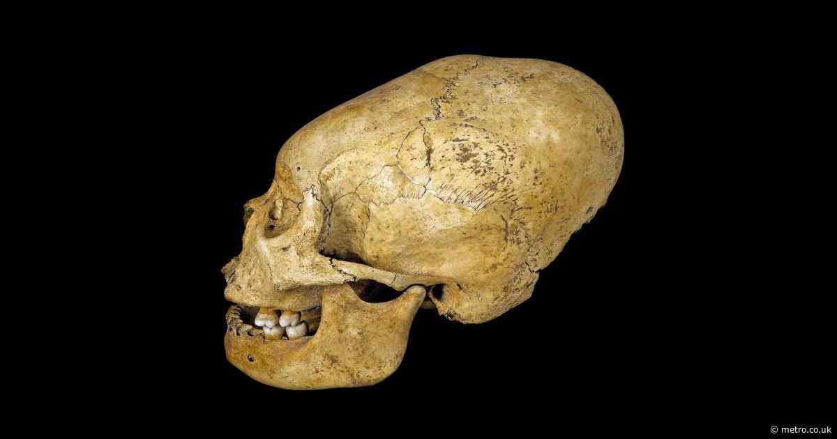 Why have so many people deformed their skulls over the years?