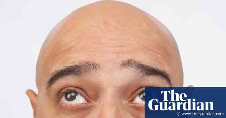 Hair yesterday, gone today: why we are happily bald | Letters