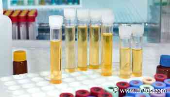 New Prostate Cancer Urine Test Has High Diagnostic Accuracy