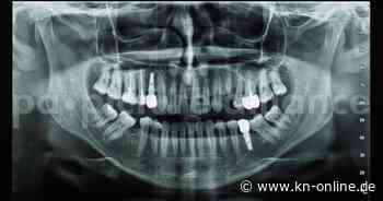 Horror-Besuch: Zahnarzt rammt Patienten Schraube ins Gehirn