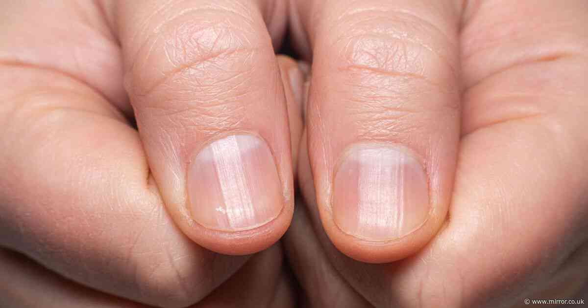 TV doctor warns of little-known nail symptom that could be sign of cancer
