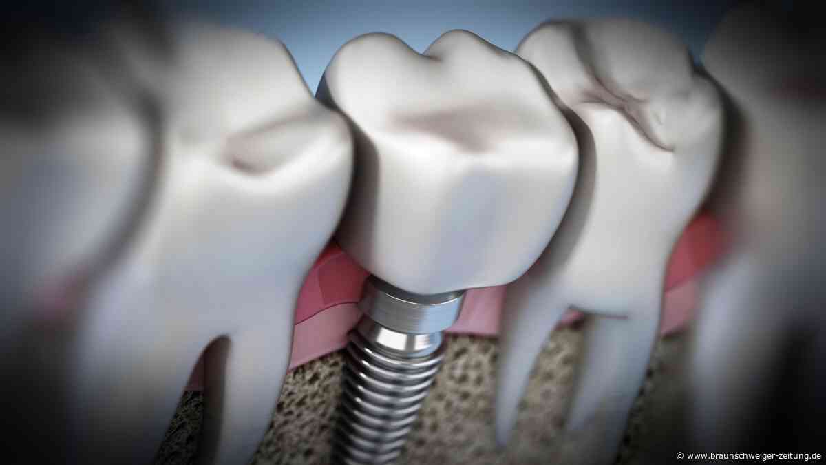 Türkei: Zahnarzt drillt Patient Titanschraube ins Gehirn