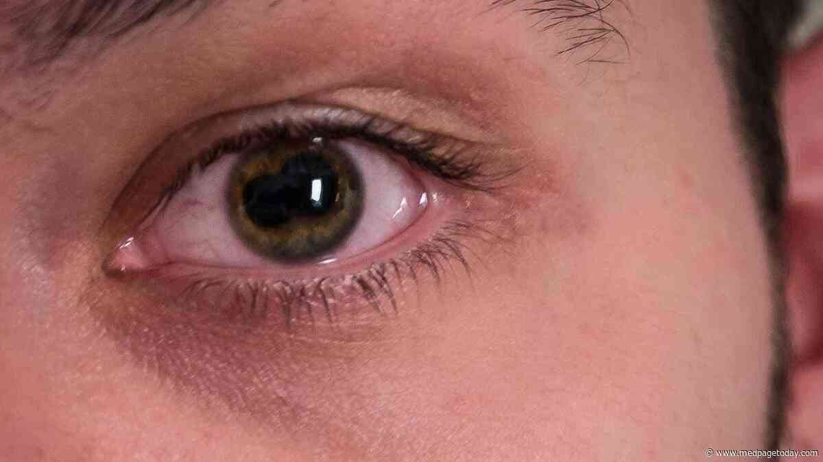 Uveitis History Linked to Recurrence After COVID Vaccination