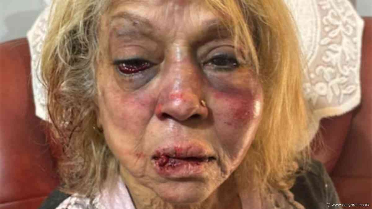 Girrawheenon home invasion: Grandmother and cancer patient speaks out about terrifying assault by men pretending to be cops