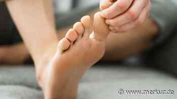 Fußpilz erkennen: Vier Symptome, die auf eine Infektion hindeuten