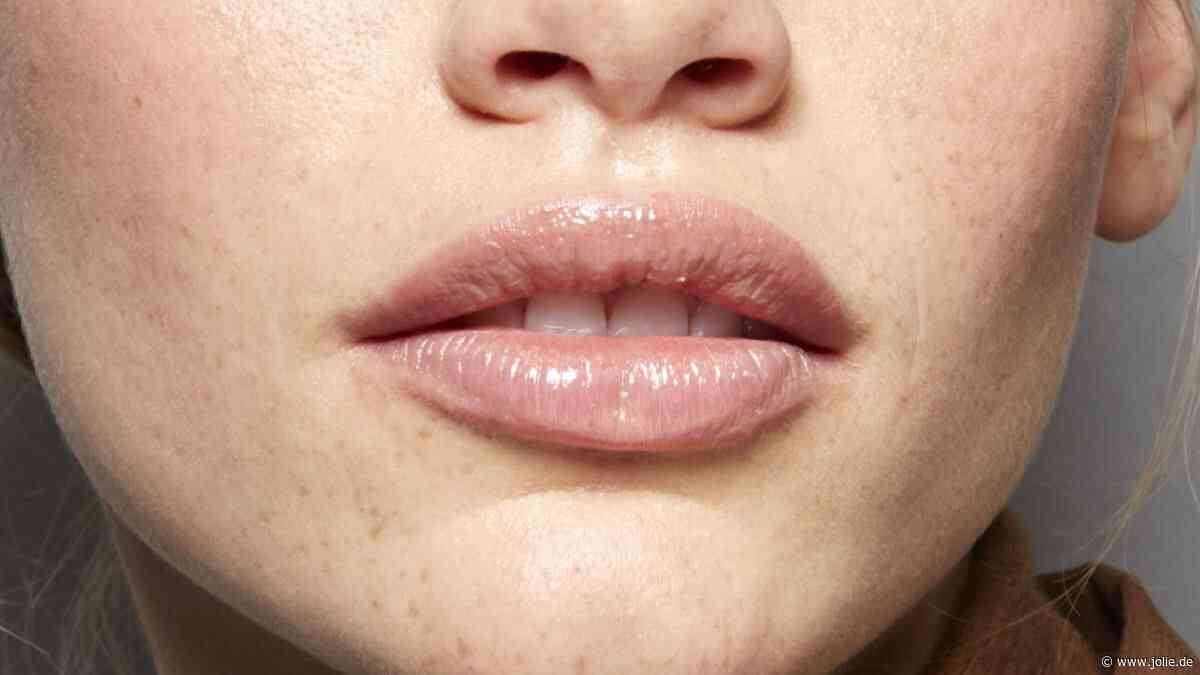 Trockene Lippen: Ursachen, Tipps und die besten Pflegemittel